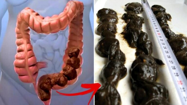 Dieser vergessene Trick sorgt für eine sanfte Darmreinigung … du wirst überrascht sein!