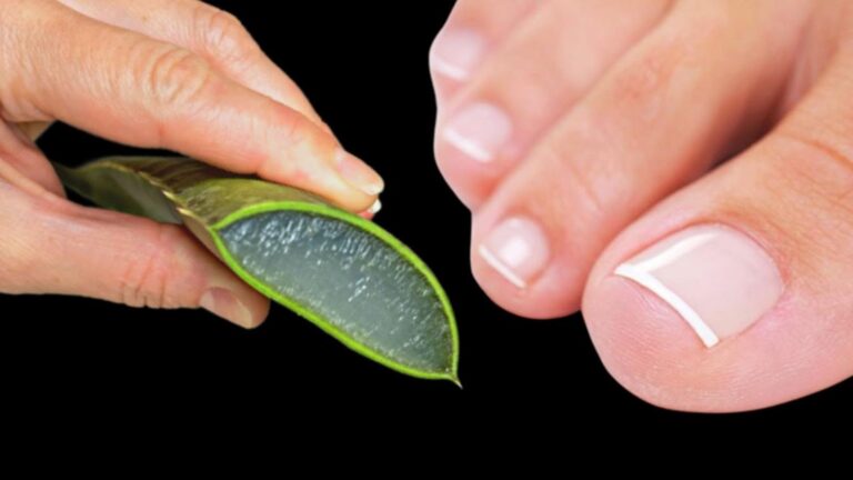 Dieser einfache Trick mit Aloe wirkt Wunder gegen Nagelpilz und zaubert gesunde Nägel…