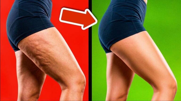 Entdecke 5 schnelle Methoden gegen Cellulite und Dehnungsstreifen für straffe Haut!