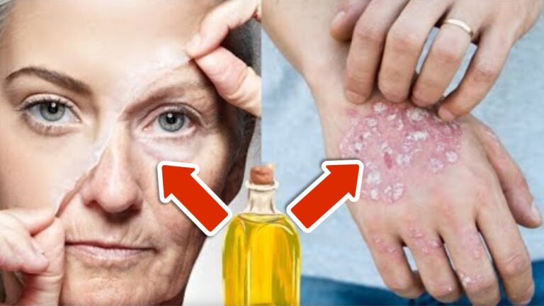 Vorstellung: 5 effektive Öle gegen Falten und trockene Haut für strahlende Schönheit!