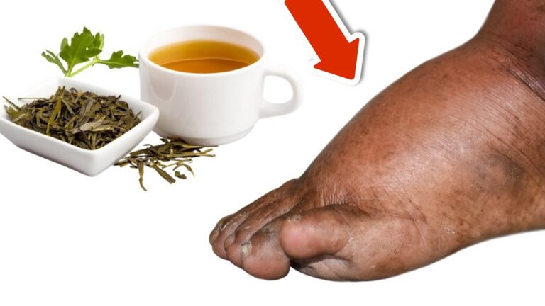 5 Teesorten gegen geschwollene Beine und Füße – Das Geheimnis für Wohlfühlen!