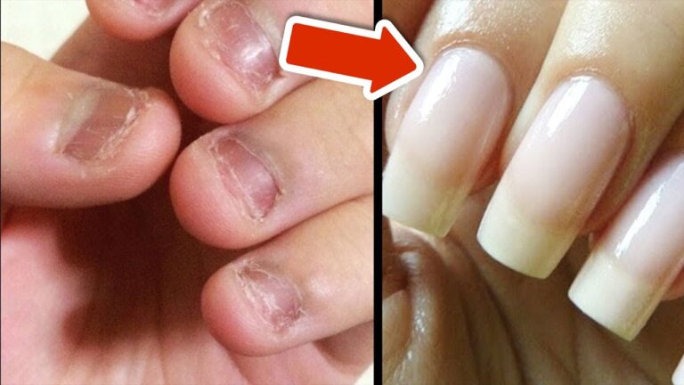 7 Schritte zu traumhaften Fingernägeln in nur 5 Tagen – So einfach klappt’s!