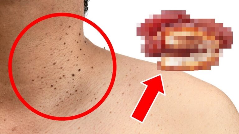7 überraschende Lebensmittel, die deine Gesundheit heimlich beeinflussen