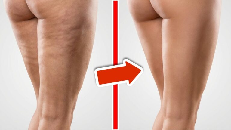 5 leckere Lebensmittel gegen Cellulite für sichtbar glatte Haut